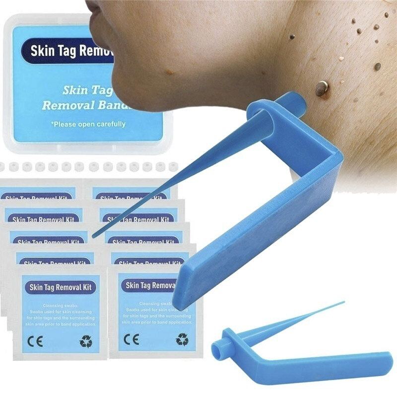 Home Micro Skin Tag Remover Set Medium Body Mole Odstraňovač Bradavic Pásek Na Odstranění Kožních Štítků